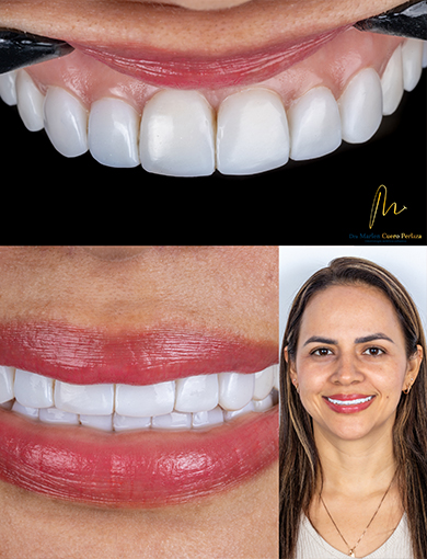 MARLEN-CUERO-011